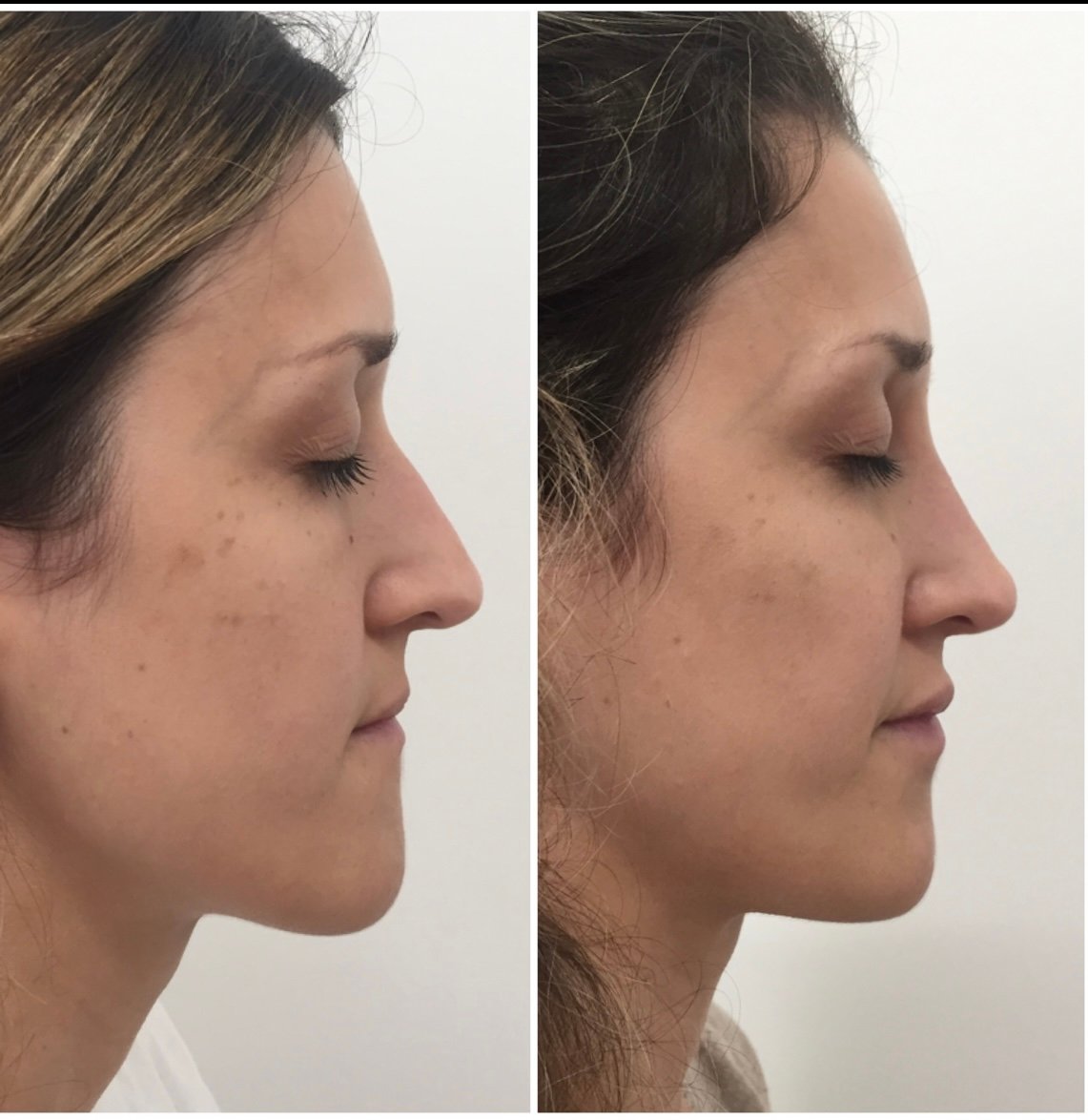 veca-veronica-carca-abal-médica-endocrinologa-metabolismo- climaterio-y- menopausia-salud-hormonal- longevidad-y medicina-estetica-servicios-veca-veronica-carca-abal-médica-endocrinologa-metabolismo- climaterio-y- menopausia-salud-hormonal- longevidad-y medicina-estetica-servicios-veca-veronica-carca-abal-médica-endocrinologa-metabolismo- climaterio-y- menopausia-salud-hormonal- longevidad-y medicina-estetica-servicios-