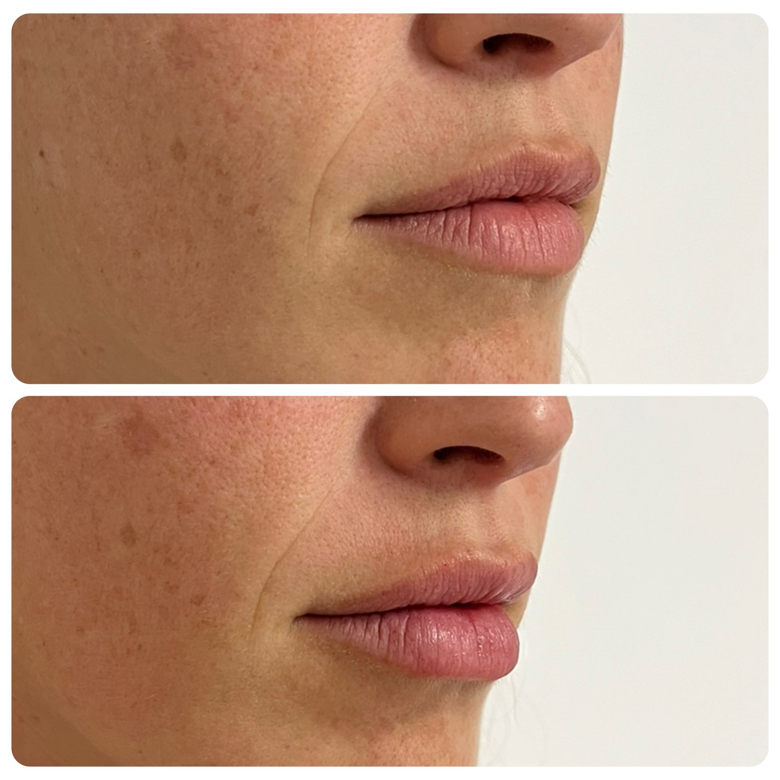 veca-veronica-carca-abal-médica-endocrinologa-metabolismo- climaterio-y- menopausia-salud-hormonal- longevidad-y medicina-estetica-servicios-hidratación-de-labios